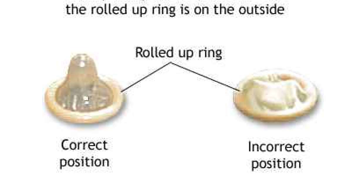 What are the benefits of condoms?