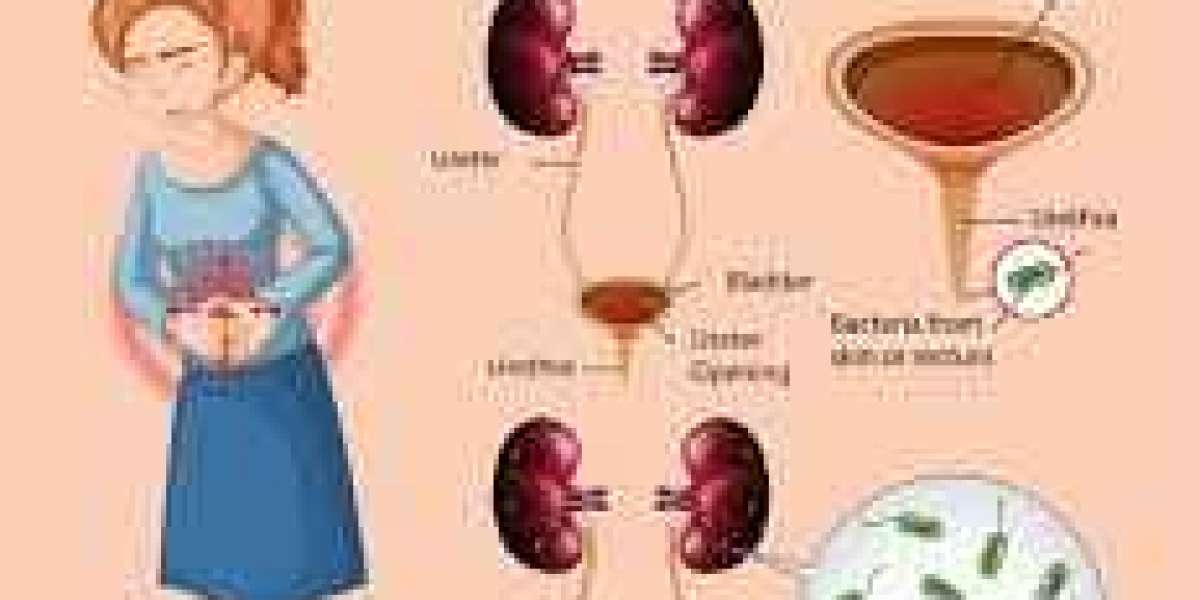 What is a urinary tract infection?