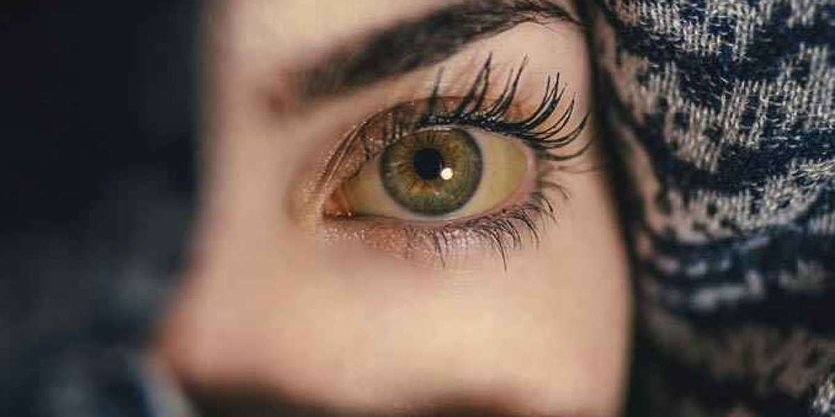 Yellow eyes: Causes and treatment