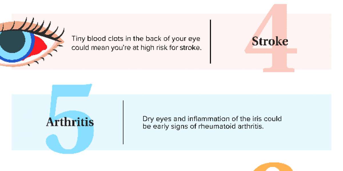 Things your eyes can reveal about your health