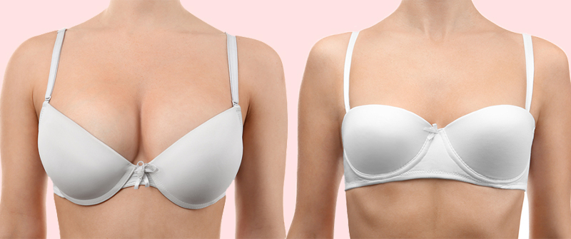 Female Breast Reduction Surgery In Delhi | Breast Reduction Surgery Cost