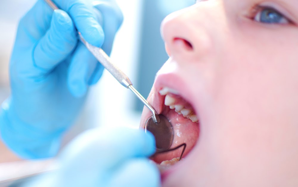 Tooth Extraction Procedure, Risks and Aftercare