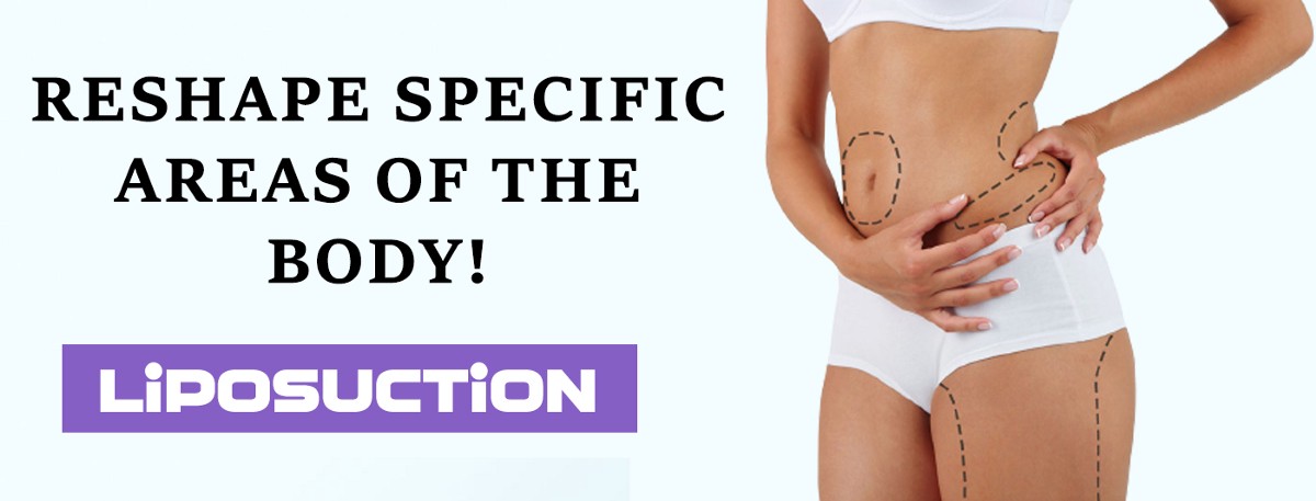 Why You Should Get Liposuction Surgery in Delhi? | by IPACT CENTER | Sep, 2022 | Medium