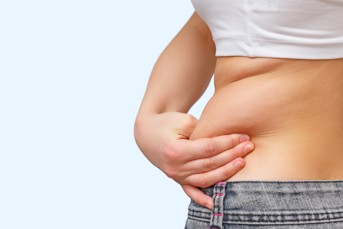 Does Fat Return After Liposuction?