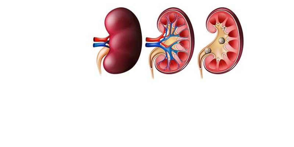 Kidney Failure: Causes, Symptoms & Treatments
