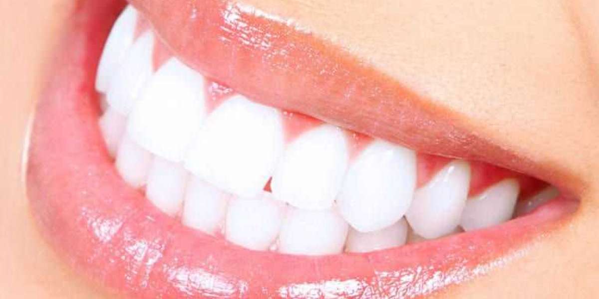 Invisalign in Gold Coast Can Help You Achieve The Perfect Smile