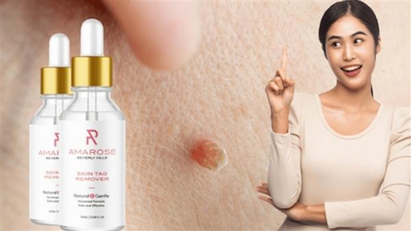 Amarose Skin Tag Remover Reviews (Is It Legit?) Price, Ingredients, Side Effects and Where to Buy? : The Tribune India