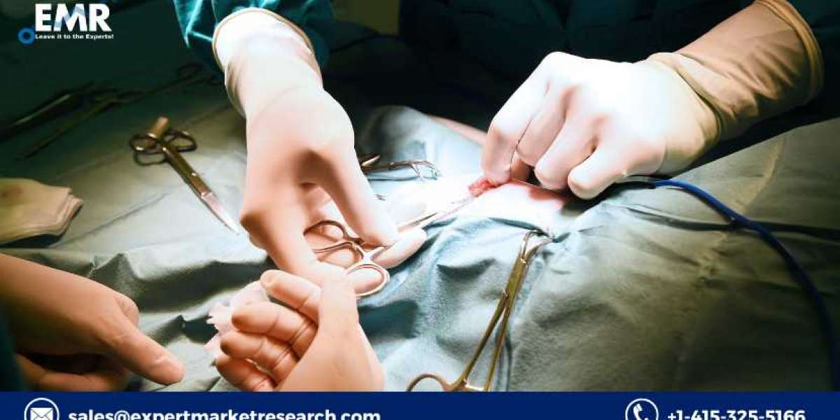 Minimally Invasive Surgery Market Analysis, Size, Share, Price, Trends, Growth, Report, Forecast 2021-2026