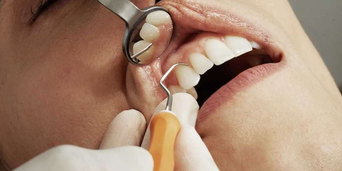 Best Dental Clinic In India