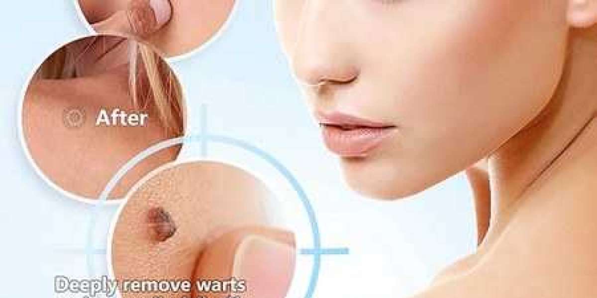 Amarose Skin Tag Remover