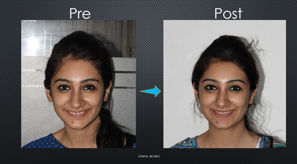 Top dentist in Delhi — A perfect smile, guaranteed | by Dental Works | Jan, 2023 | Medium