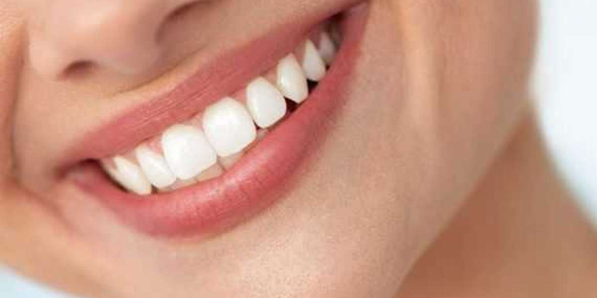 What are the options for cosmetic dentistry in Cedar Rapids?