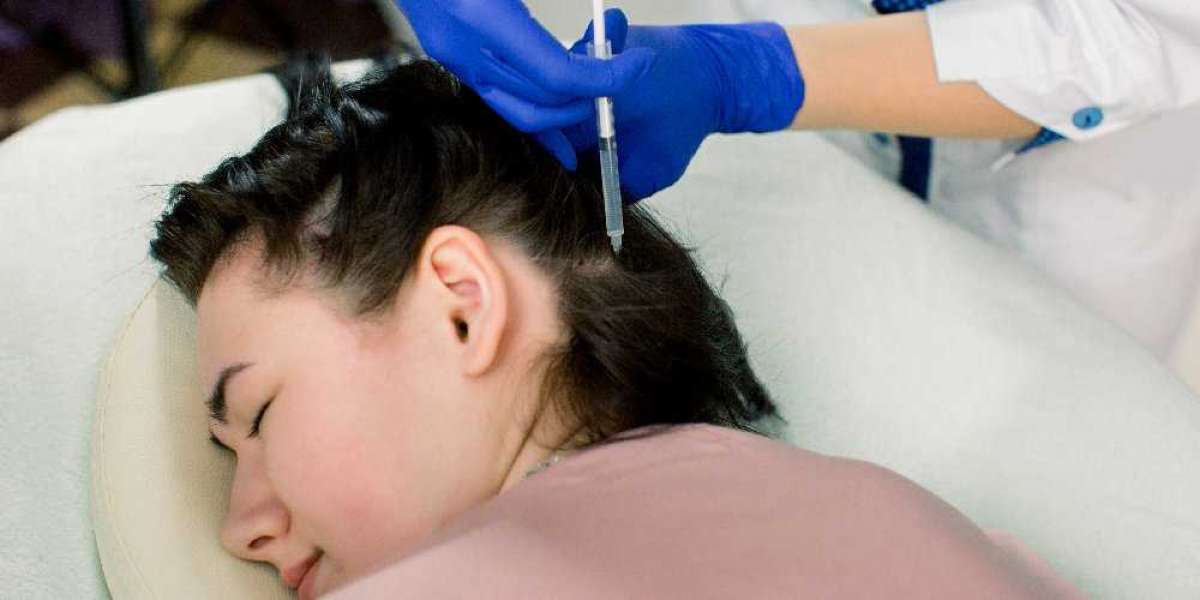 Follicular Unit Extraction - An Effective Hair Restoration Technique