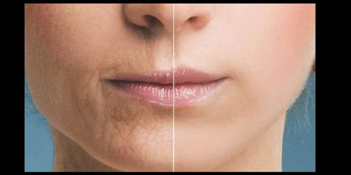 AGING LIPS??? | THINNING, LINES, AND DRYNESS