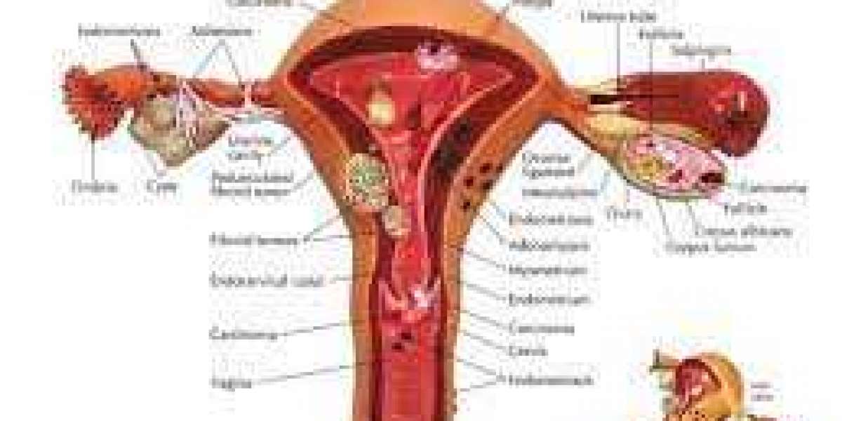 Womb (Uterus) Cancer: Symptoms, Causes, Treatment, and Prevention