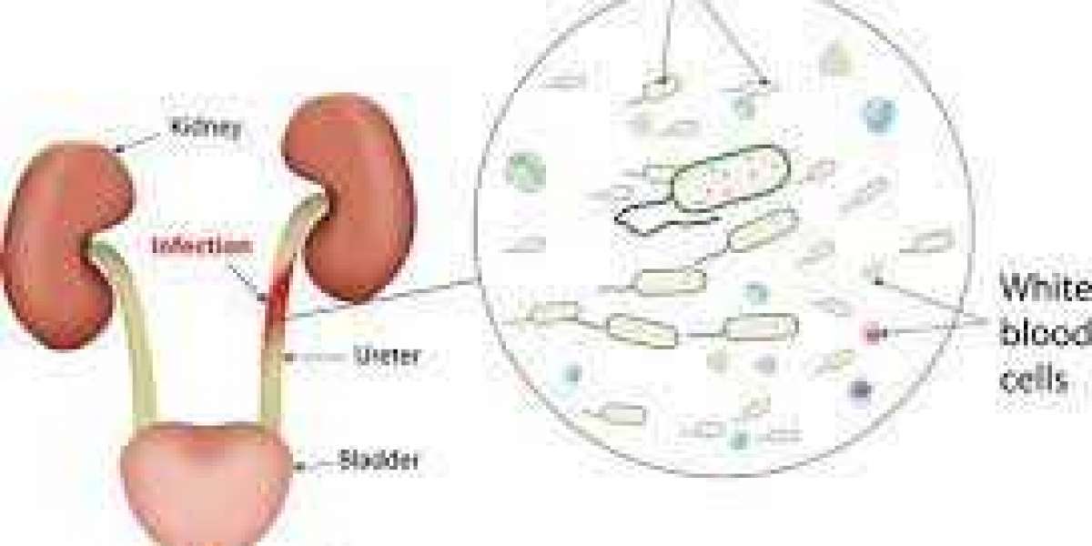 Urinary Tract Infection (UTI) in Children: Symptoms, Causes, Treatment and Prevention