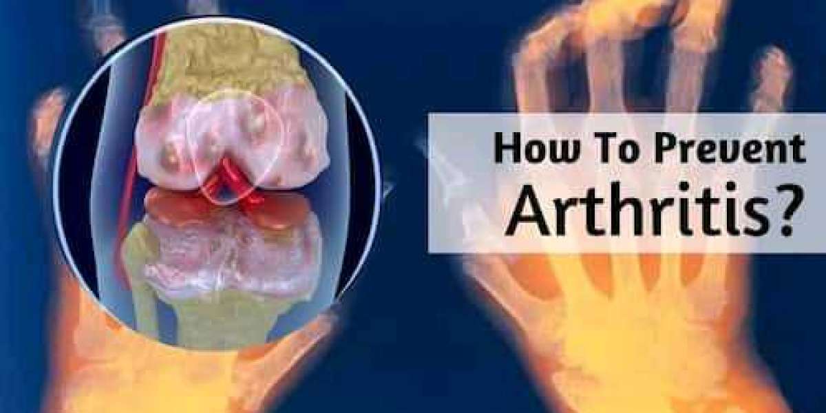 The most effective method to Forestall Joint inflammation: 10 Things You Can Do To Keep Your Bones Sound