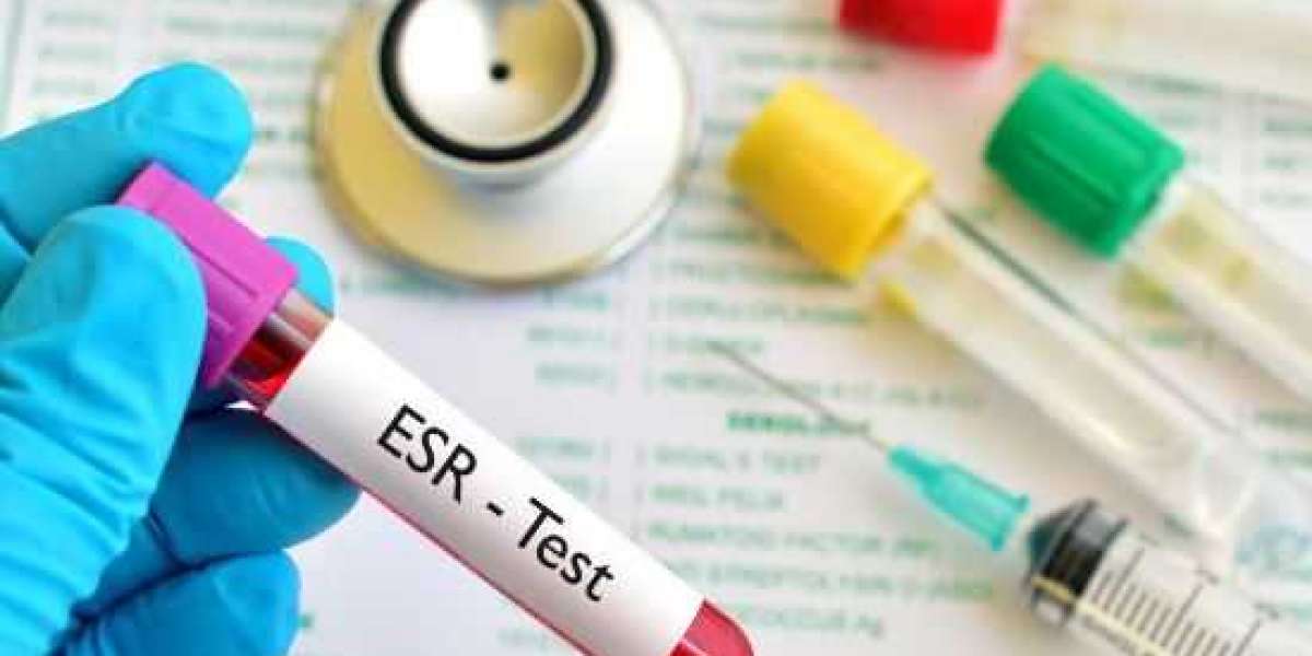 ESR Test in Chennai: Assessing Inflammation Levels for Optimal Health