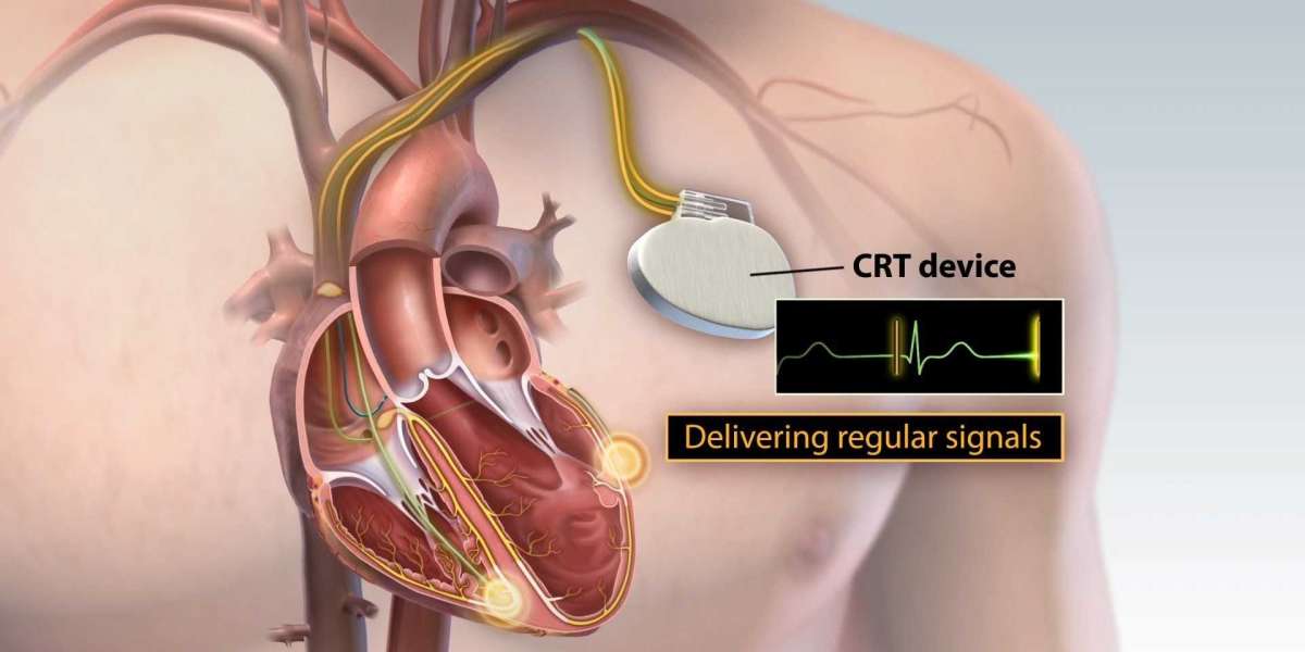 Global Cardiac Resynchronization Therapy (CRT) Market Share to Worth USD 4.09 Billion by 2030
