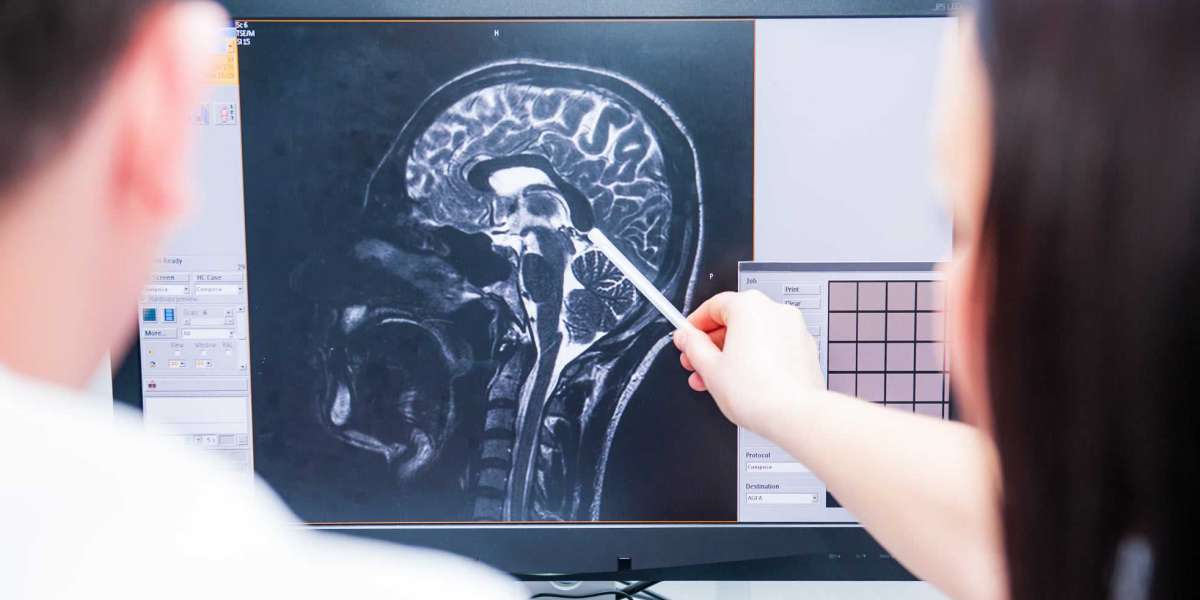 Understanding the Role of a Traumatic Brain Injury Attorney in San Francisco