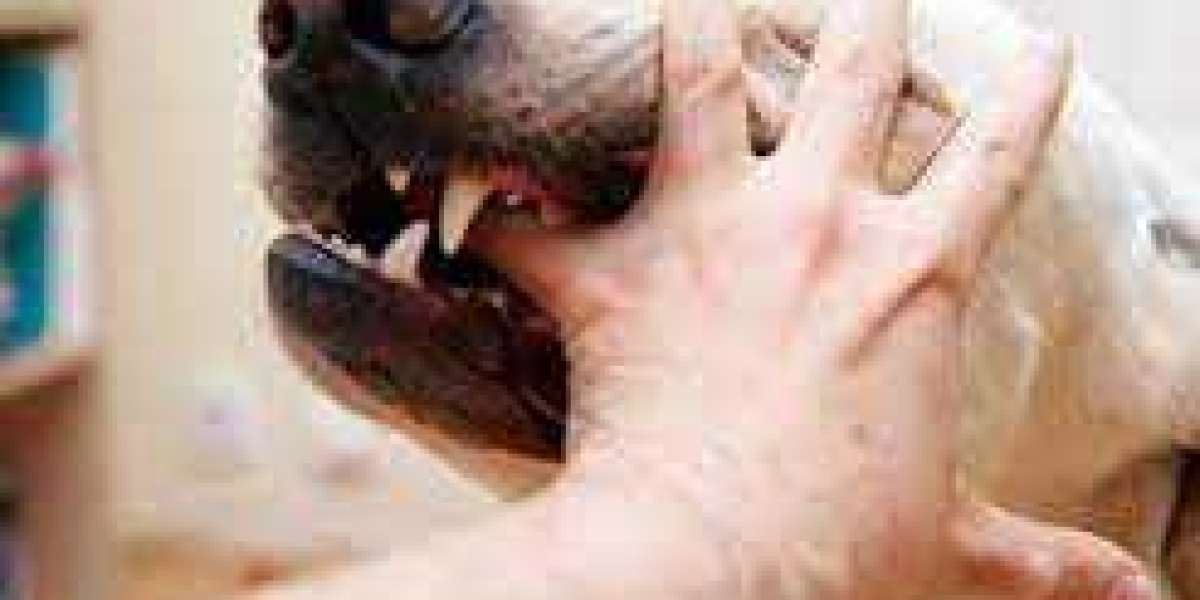 Dog Bite Lawyers In Palm Desert -The Support You Need And The Settlement You Deserve