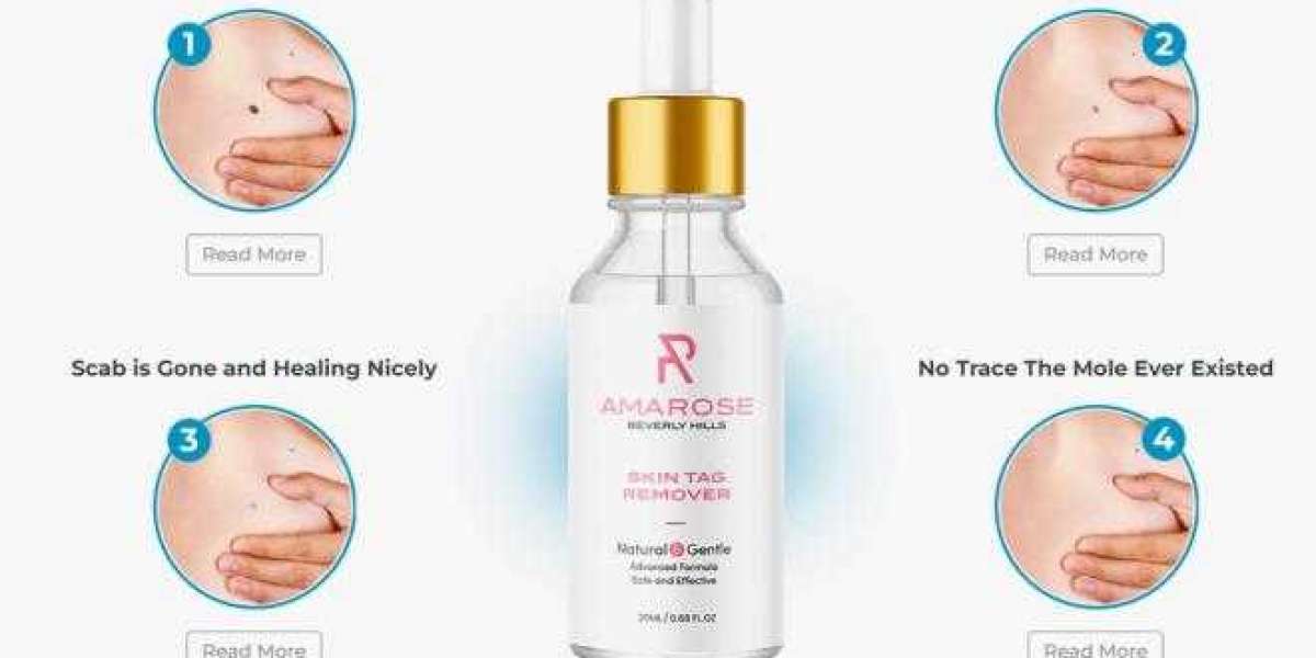 Amarose Skin Tag Remover: Unveiling the Secret to Beautiful Skin