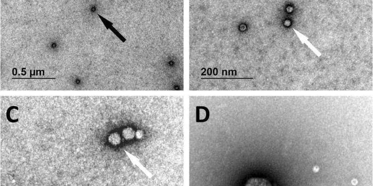 Viral Vector Characterization: Why and How