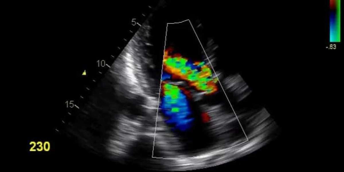 Best COLOR DOPPLER Centre Test in South Ex: A Comprehensive Guide