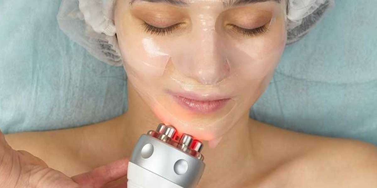 Radio Frequency Skin Tightening