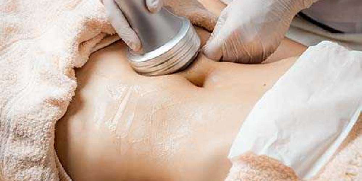 Laser Lipo in Las Vegas: Sculpt Your Way to a Stunning Physique