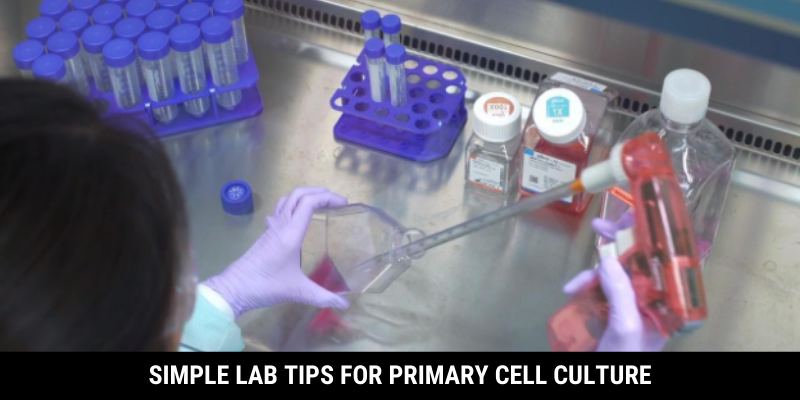 Simple Lab Tips For Primary Cell Culture – Primary Stem Cells for Industrial & Academic Research – Kosheeka