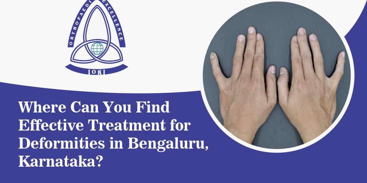 Where Can You Find Effective Treatment for Deformities in Bengaluru, Karnataka?