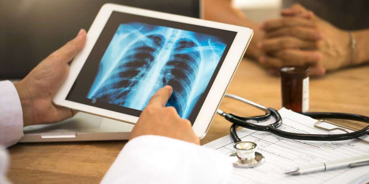 Understanding the Benefits of Digital X-Ray Over Traditional X-Ray Techniques