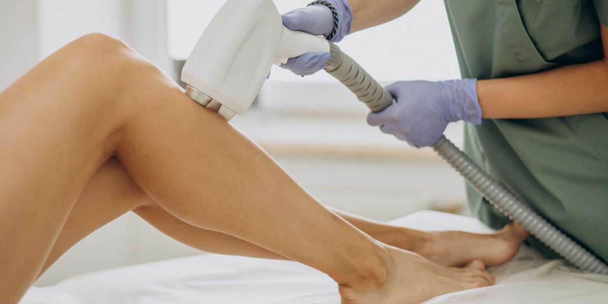 Choosing Physician-Led Laser Hair Removal: A Wise Decision