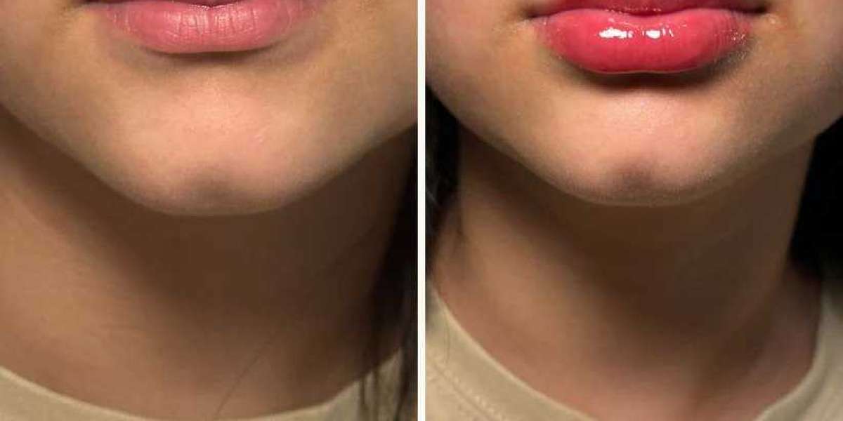 The Science of Lip Plumper Gloss: How Does It Really Work?
