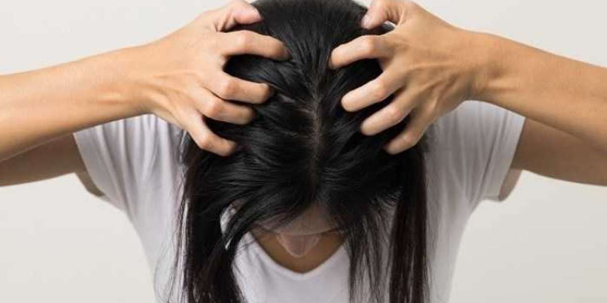 Mengenal Kutu Rambut, Pencegahan dan Pengobatan Efektif