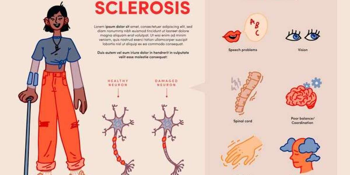 Understanding Multiple Sclerosis (MS): From Diagnosis to Managing Daily Life Challenges