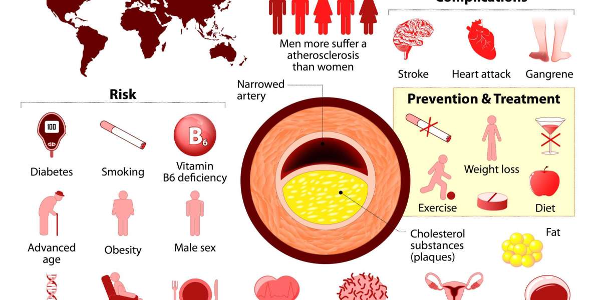 The Arteriosclerosis Epidemic: A Comprehensive Analysis