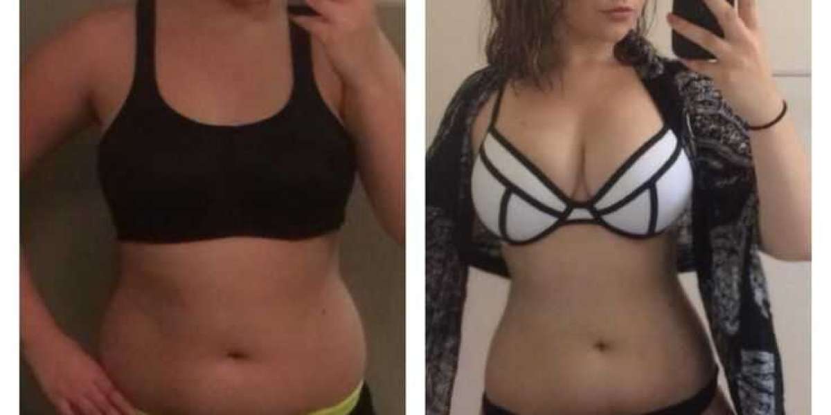 https://keto-drops-acv-gummies.company.site/