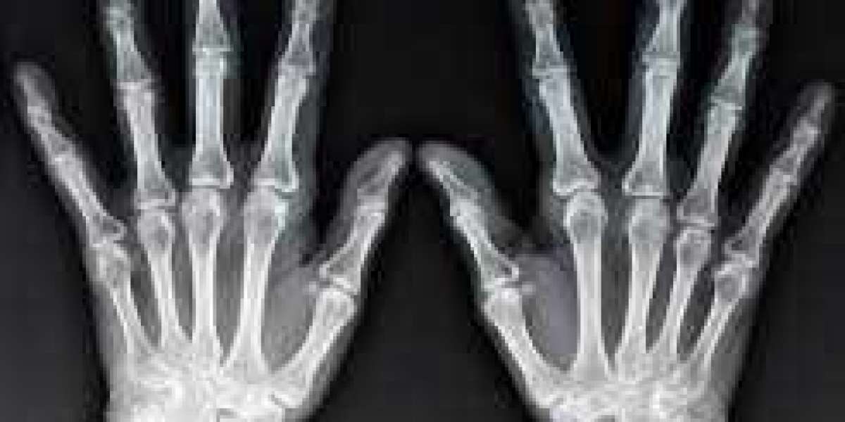 The Value of X-Rays in The Diagnosis of Many Diseases