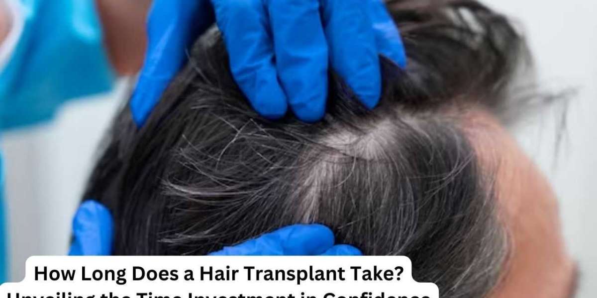 How Long Does a Hair Transplant Take? Unveiling the Time Investment in Confidence