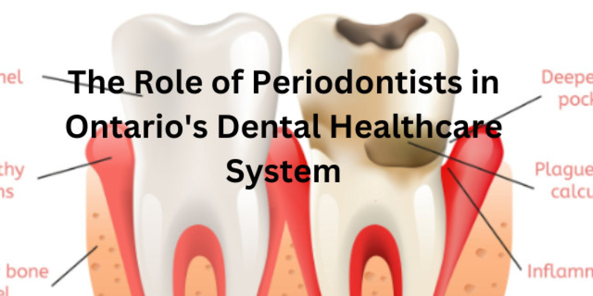 The Role of Periodontists in Ontario's Dental Healthcare System