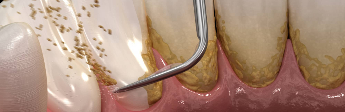 Avdental Surgerycenter Cover Image