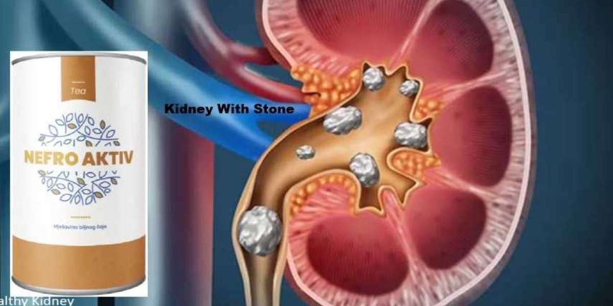 Nefro Aktiv: Čaj Njega prirodnog kamena u bubregu i jetre (Bosnia and Herzegovina)