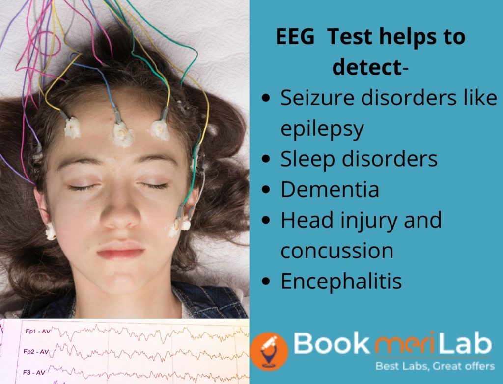 EEG Test: Price, Purpose, Procedure, Preparation & Risks [2024]