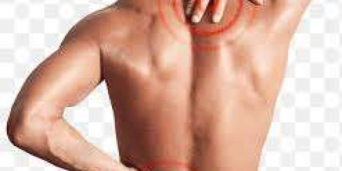 Mastering Chronic Back Pain: Expert Strategies for Relief