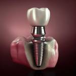 DENTAL & DENTURE CLINIC Profile Picture