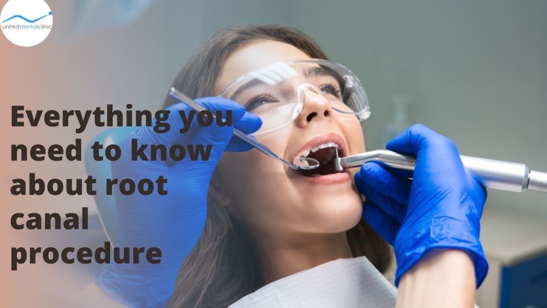 Everything you need to know about root canal procedure - Business News Tips