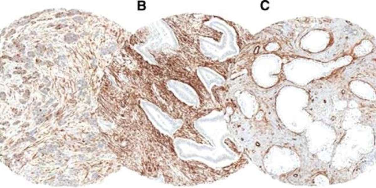 Unlocking the Strength of Cytoskeletal Protein Antibodies