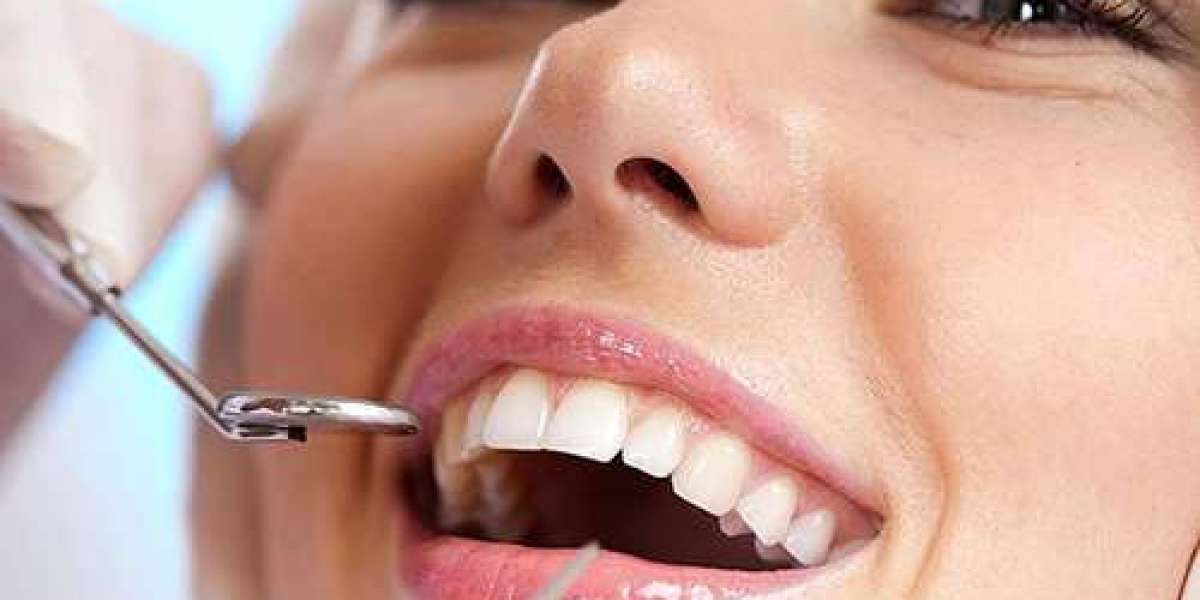 Achieving Your Desired Smile: Cosmetic Dentistry in Tampa
